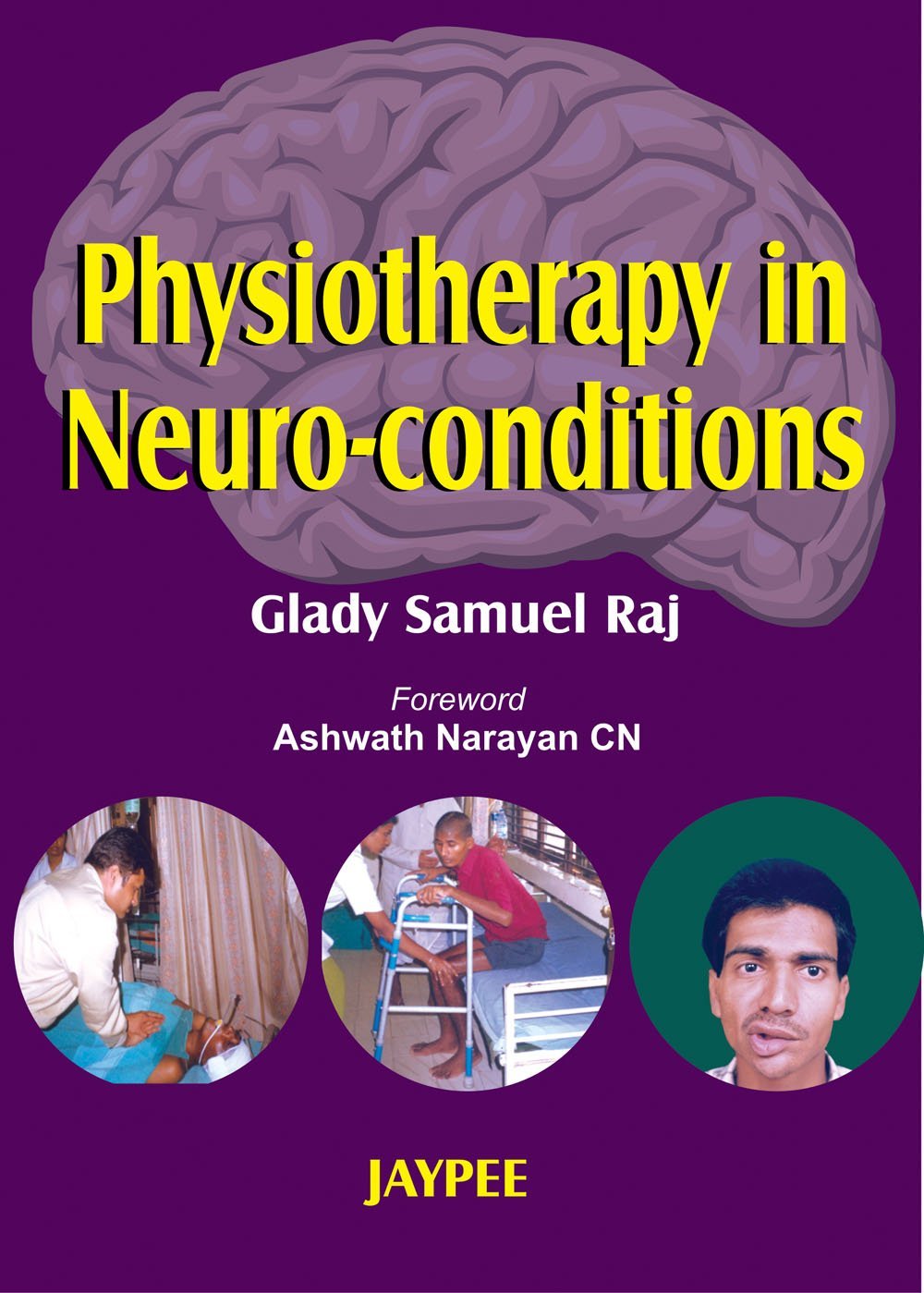 physiotherapy in neuro conditions glady physiotherapy in neuro conditions glady